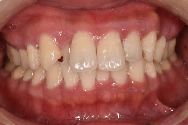 Before image